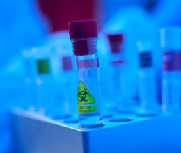 A fertőzöttek 90 százaléka belehal az új vírusba, amit egy kínai laboratóriumban fejlesztettek ki